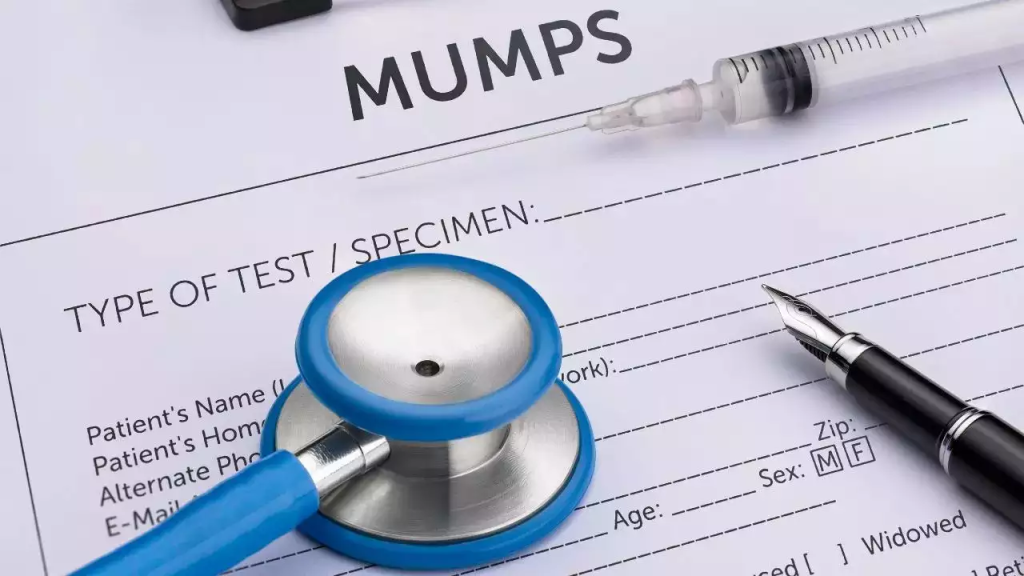 Mumps Virus