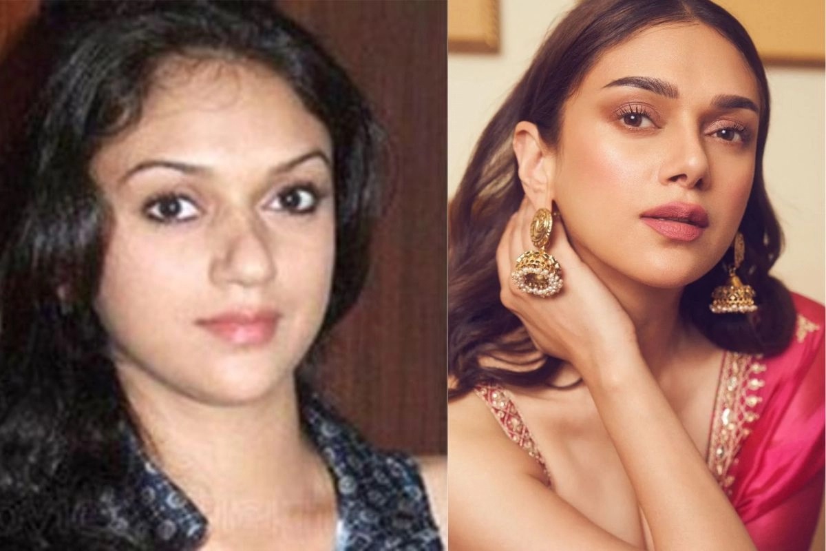 aditi rao nose job